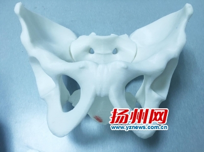 3D打印骨盆模型 帮助老汉成功切除前列腺癌